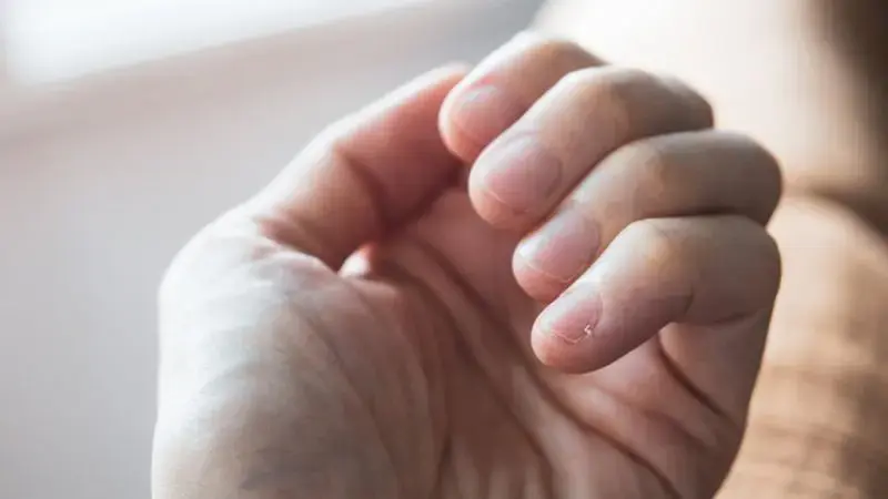 Cómo tus uñas te advierten sobre tu salud y ayudan a detectar enfermedades